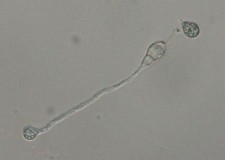 胞子が発芽した様子